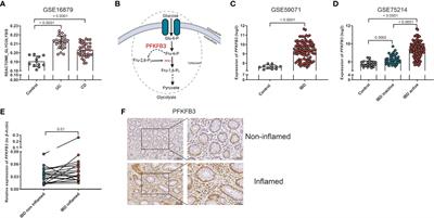 Increased stromal PFKFB3-mediated glycolysis in inflammatory bowel disease contributes to intestinal inflammation